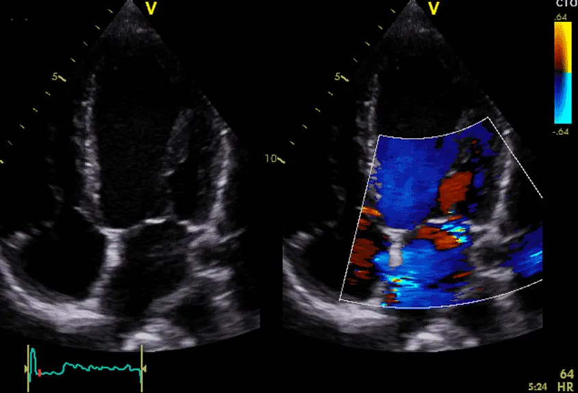 Basin Cardiovascular Imaging LLC